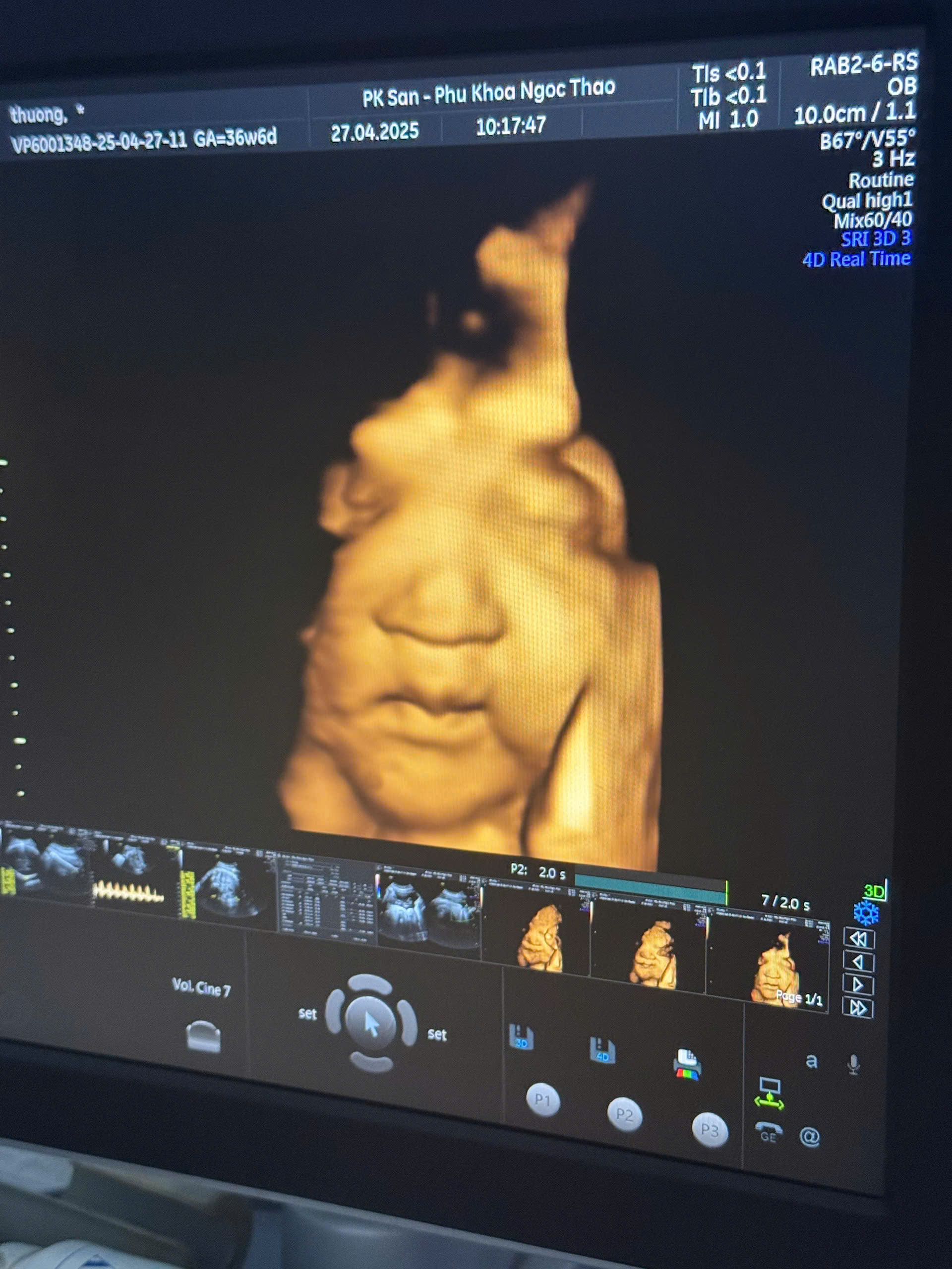 Khoảnh khắc khi con còn là một điều bé xíu trong bụng mẹ